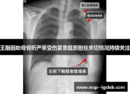 王刚因肋骨骨折严重受伤紧急就医粉丝关切情况持续关注
